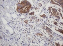 LRCH4 Antibody (OTI1F8), Novus Biologicals 0.1mL; Unlabeled:Antibodies,