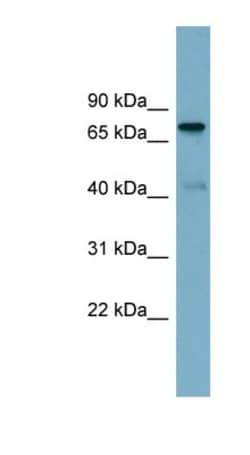 LRDD Antibody, Novus Biologicals 100 &mu;L | Buy Online | Novus Biologicals | Fisher Scientific