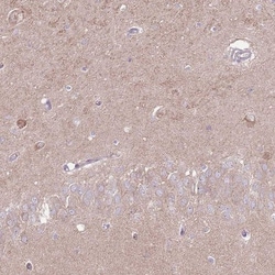 SALM4/LRFN3 Antibody, Novus Biologicals:Antibodies:Primary Antibodies