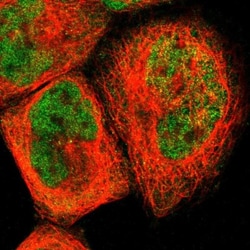 LRFN5 Antibody, Novus Biologicals:Antibodies:Primary Antibodies