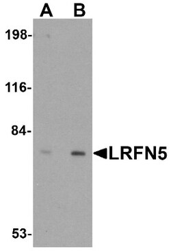 LRFN5 Antibody - BSA Free, Novus Biologicals 0.1mg; Unlabeled:Antibodies,