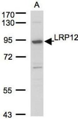 ST7/LRP12 Antibody, Novus Biologicals 0.1mg; Unlabeled:Antibodies, Polyclonal