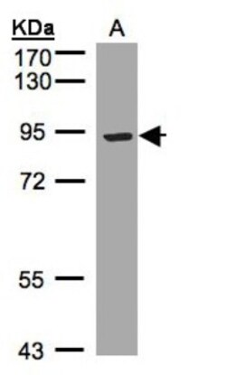 ST7/LRP12 Antibody, Novus Biologicals 0.1mg; Unlabeled:Antibodies, Polyclonal