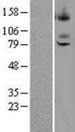 Novus Biologicals&trade;&nbsp;ST7/LRP12 Overexpression Lysate