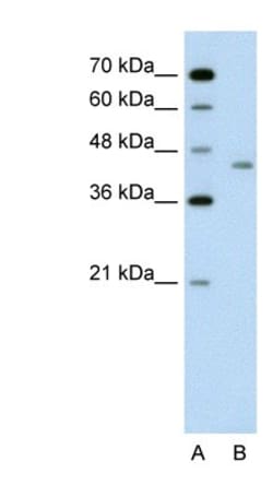 LRP2BP Antibody, Novus Biologicals 100 &mu;L | Buy Online | Novus Biologicals | Fisher Scientific