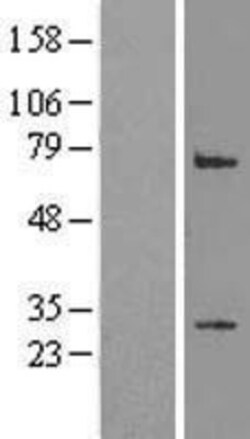 Novus Biologicals&trade;&nbsp;LRP2BP Overexpression Lysate