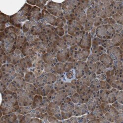 LRP-4 Antibody, Novus Biologicals:Antibodies:Primary Antibodies