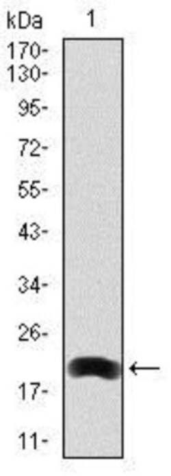 LRP-5 Antibody (2B11) - BSA Free, Novus Biologicals 0.1mL; Unlabeled:Antibodies,