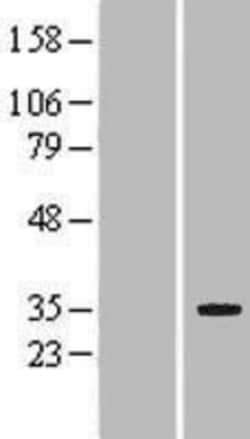 Novus Biologicals&trade;&nbsp;LRP5L Overexpression Lysate