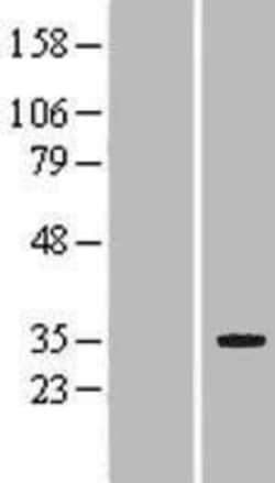 Novus Biologicals&trade;&nbsp;LRP5L Overexpression Lysate