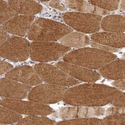 LRP5L Antibody, Novus Biologicals:Antibodies:Primary Antibodies