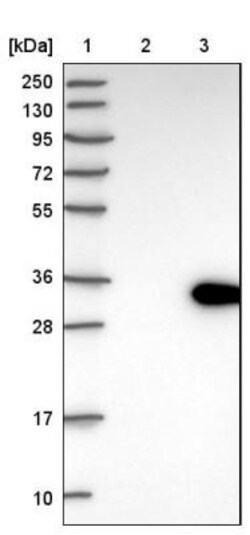 LRP5L Antibody, Novus Biologicals:Antibodies:Primary Antibodies
