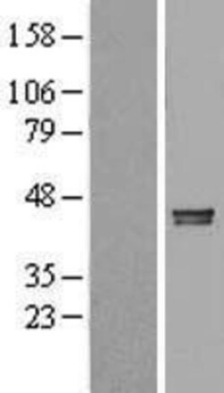 Novus Biologicals&trade;&nbsp;LRPAP Overexpression Lysate