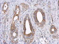 LRPPRC Antibody, Novus Biologicals 0.1mL; Unlabeled:Antibodies, Polyclonal
