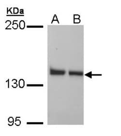LRPPRC Antibody, Novus Biologicals 100 &mu;L | Buy Online | Novus Biologicals | Fisher Scientific