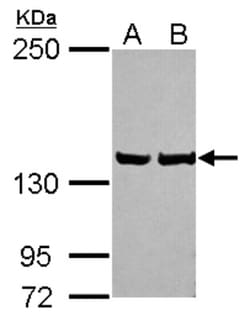 LRPPRC Antibody, Novus Biologicals 0.1mL; Unlabeled:Antibodies, Polyclonal