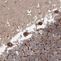 LRPPRC Antibody, Novus Biologicals 25 &mu;L; Unlabeled:Antibodies, Polyclonal