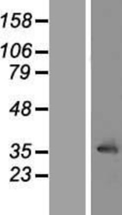 Novus Biologicals&trade;&nbsp;LRRC10 Overexpression Lysate