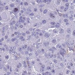 LRRC10B Antibody, Novus Biologicals 25 &mu;L | Buy Online | Novus Biologicals | Fisher Scientific