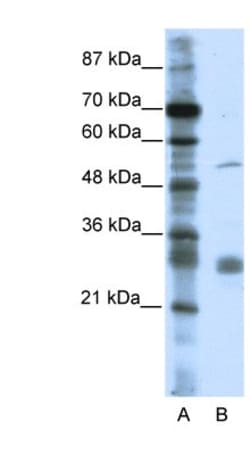 LRRC14 Antibody, Novus Biologicals:Antibodies:Primary Antibodies
