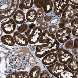 LRRC14 Antibody, Novus Biologicals 0.1mL; Unlabeled:Antibodies, Polyclonal
