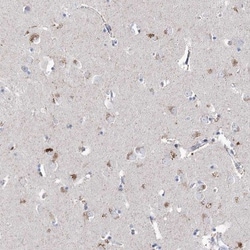 LRRC14B Antibody, Novus Biologicals:Antibodies:Primary Antibodies