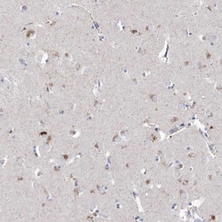 LRRC14B Antibody, Novus Biologicals:Antibodies:Primary Antibodies