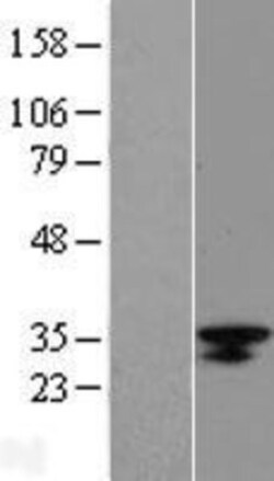 Novus Biologicals&trade;&nbsp;LRRC18 Overexpression Lysate