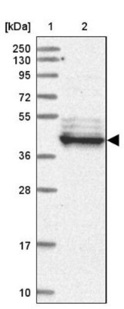 LRRC2 Antibody, Novus Biologicals:Antibodies:Primary Antibodies