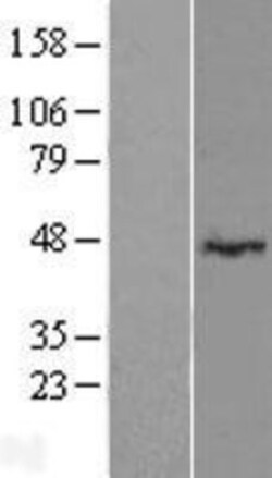 Novus Biologicals&trade;&nbsp;LRRC2 Overexpression Lysate