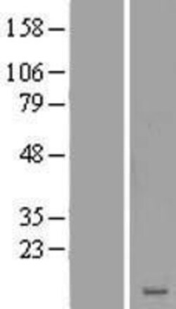 Novus Biologicals&trade;&nbsp;LRRC20 Overexpression Lysate