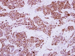 LRRC23 Antibody, Novus Biologicals 0.1mL; Unlabeled:Antibodies, Polyclonal