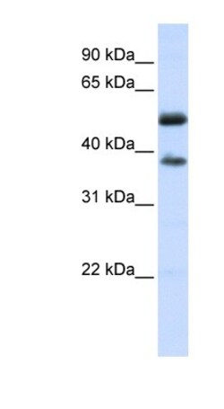 LRRC24 Antibody, Novus Biologicals:Antibodies:Primary Antibodies