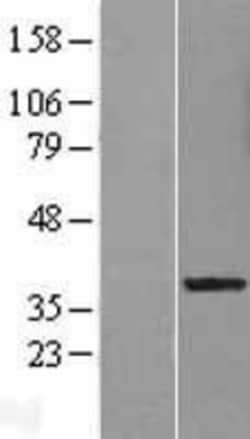 Novus Biologicals&trade;&nbsp;LRRC28 Overexpression Lysate