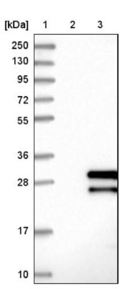LRRC29 Antibody, Novus Biologicals:Antibodies:Primary Antibodies