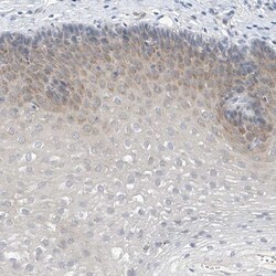 LRRC29 Antibody, Novus Biologicals:Antibodies:Primary Antibodies
