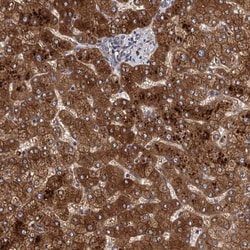 LRRC2 Antibody, Novus Biologicals:Antibodies:Primary Antibodies