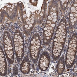 LRRC2 Antibody, Novus Biologicals:Antibodies:Primary Antibodies