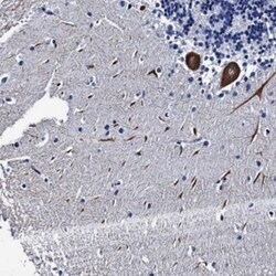 LRRC30 Antibody, Novus Biologicals 0.1mL; Unlabeled:Antibodies, Polyclonal
