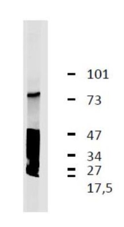 LRRC32/GARP Antibody (GARP5) - BSA Free, Novus Biologicals 0.1mg; Unlabeled:Antibodies,