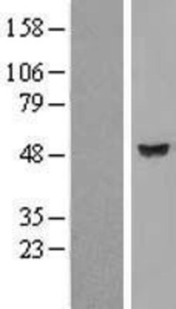 Novus Biologicals&trade;&nbsp;LRRC35 Overexpression Lysate