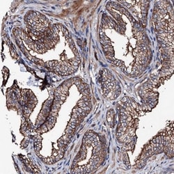 LRRC35 Antibody, Novus Biologicals 0.1mL; Unlabeled:Antibodies, Polyclonal