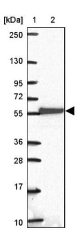LRRC36 Antibody, Novus Biologicals:Antibodies:Primary Antibodies