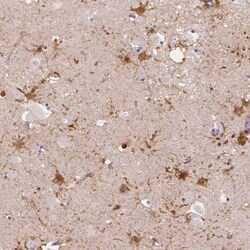 LRRC36 Antibody, Novus Biologicals:Antibodies:Primary Antibodies