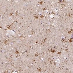 LRRC36 Antibody, Novus Biologicals:Antibodies:Primary Antibodies