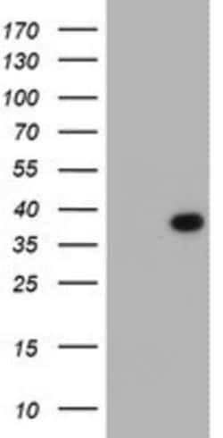 LRRC39 Antibody (OTI2D9), Novus Biologicals 0.1mL; Unlabeled:Antibodies,