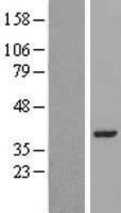 Novus Biologicals&trade;&nbsp;LRRC39 Overexpression Lysate