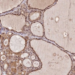 LRRC43 Antibody, Novus Biologicals:Antibodies:Primary Antibodies