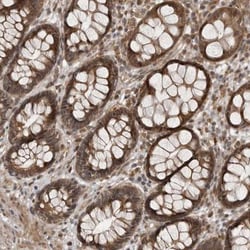 LRRC45 Antibody, Novus Biologicals 25 &mu;L | Buy Online | Novus Biologicals | Fisher Scientific