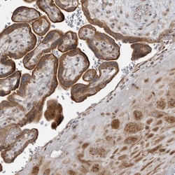 LRRC45 Antibody, Novus Biologicals 25 &mu;L | Buy Online | Novus Biologicals | Fisher Scientific